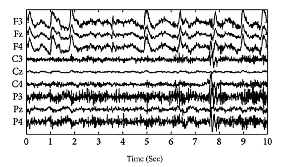 Multi-channel EEG Signal