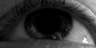 Nystagmus Patterns