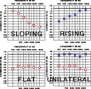 Audiogram Types