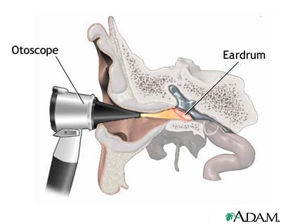 Otoscopic Examination