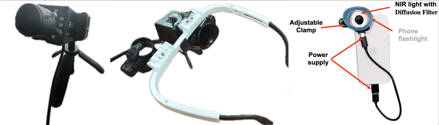 AudioSight Device Prototypes